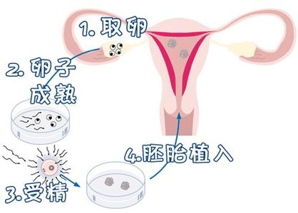 青碧生殖医学中心